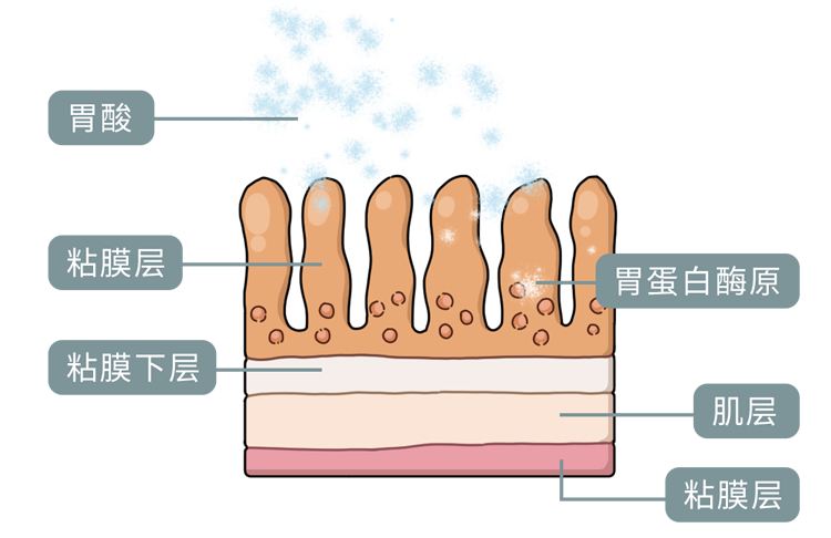 天天熬夜、吃外卖，29岁小伙腹胀消化不良，检查时已是胃癌