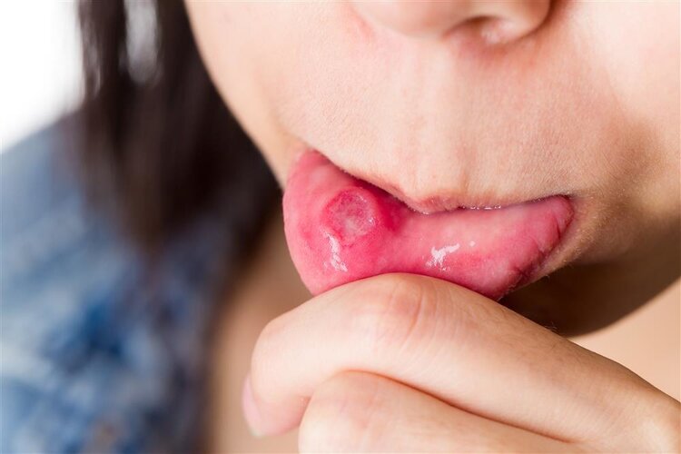 吃瓜子就是喝油？瓜子还能不能吃？过年真正不能吃的是这2种